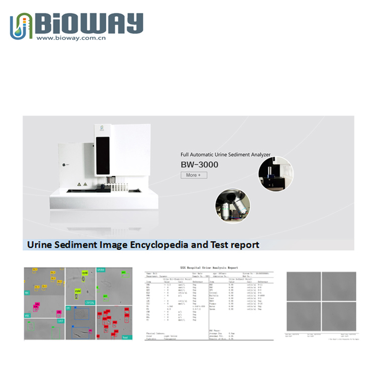 Bioway BW-3000 Urine Sediment Analyzer view 7
